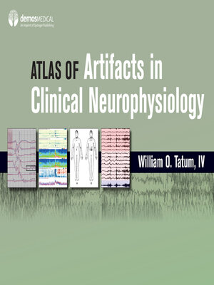 cover image of Atlas of Artifacts in Clinical Neurophysiology
